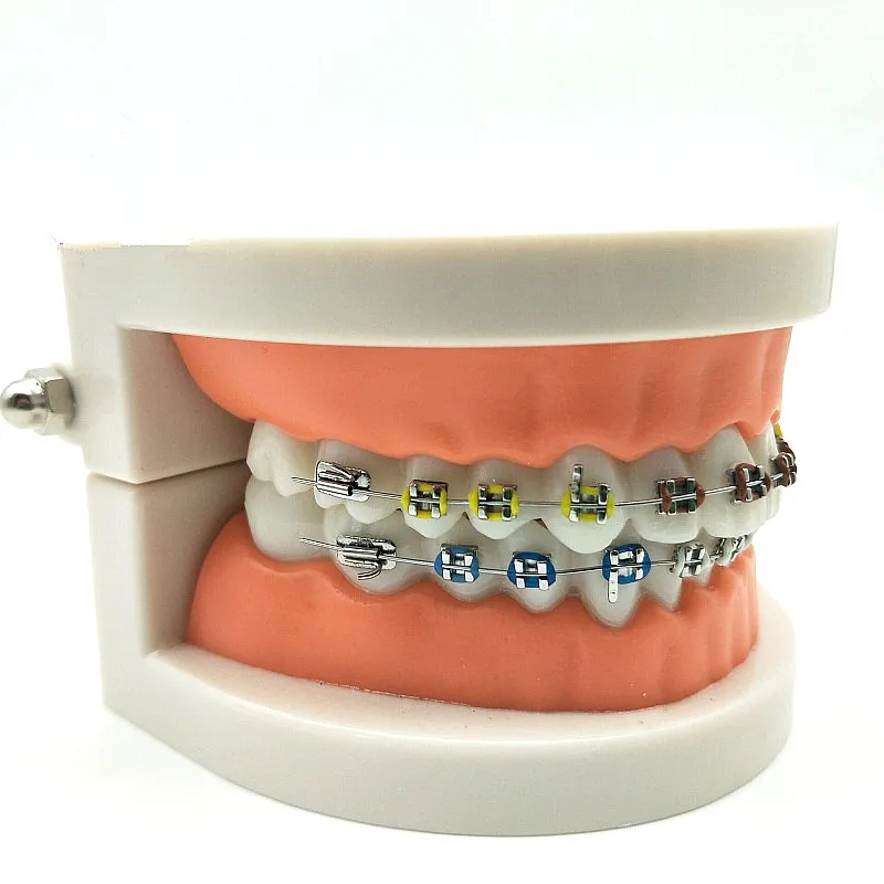 1 Шт Модель Ортодонтического Лечения Зубов С Орто Металлокерамическим Брекетом Дугообразной Проволокой Буккальной Трубкой Лигатурными Стяжками